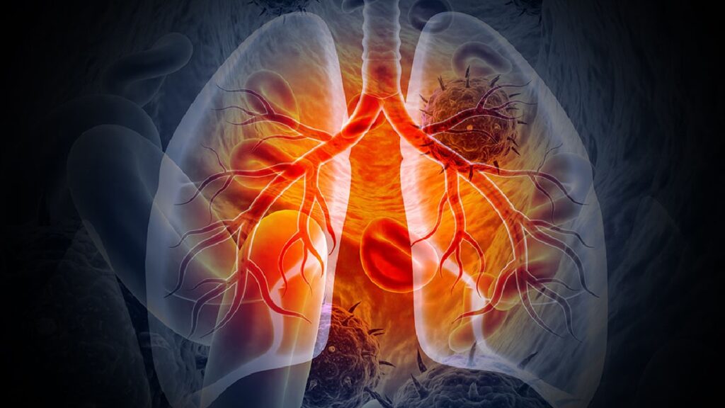 Simple Lifestyle Changes for Better Lung Health