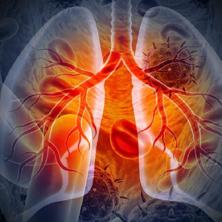 Simple Lifestyle Changes for Better Lung Health